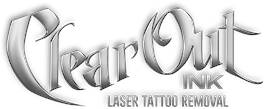 Clear Out Ink Laser Tattoo Removal